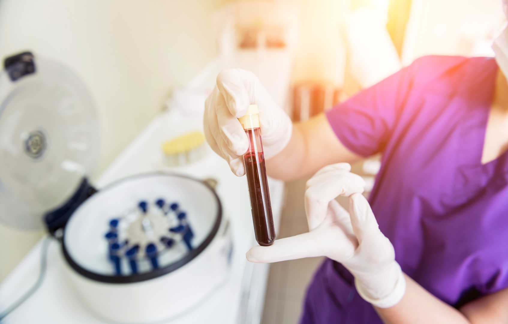 Terapia PRP vaginală - rejuvenare naturală cu plasmă bogată în trombocite